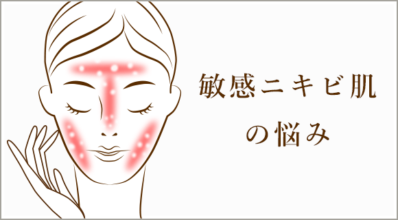 敏感ニキビ肌の悩み